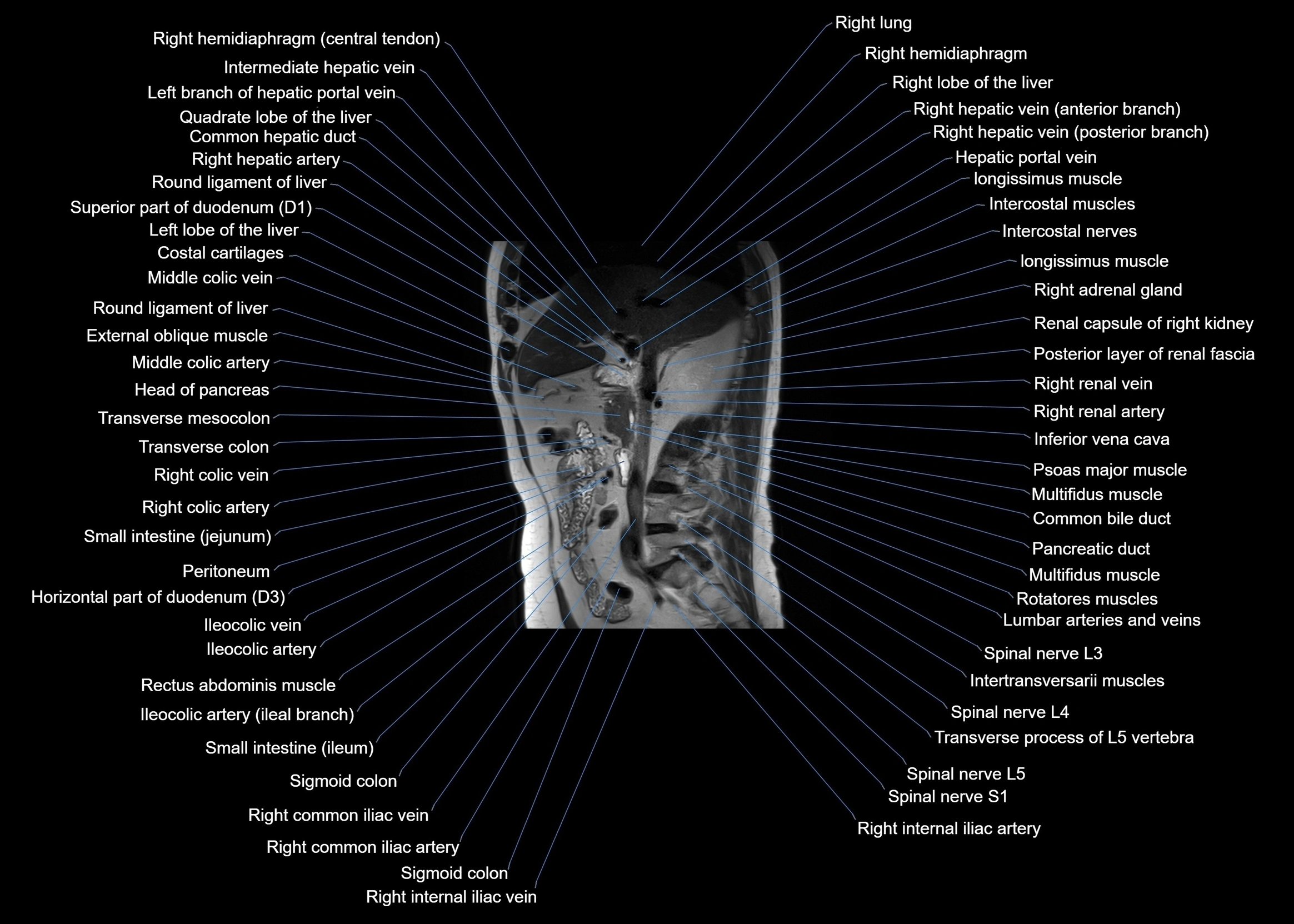 MRI abdomen sagittal cross sectional anatomy  radiology  image-img-00001-00031.webp